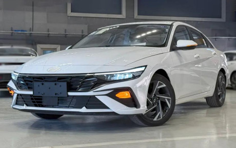 هیوندای النترا ۲۰۲۵